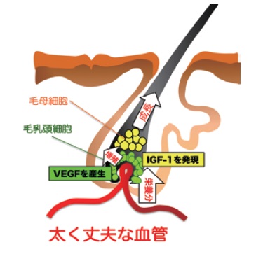 毛根のイメージ図